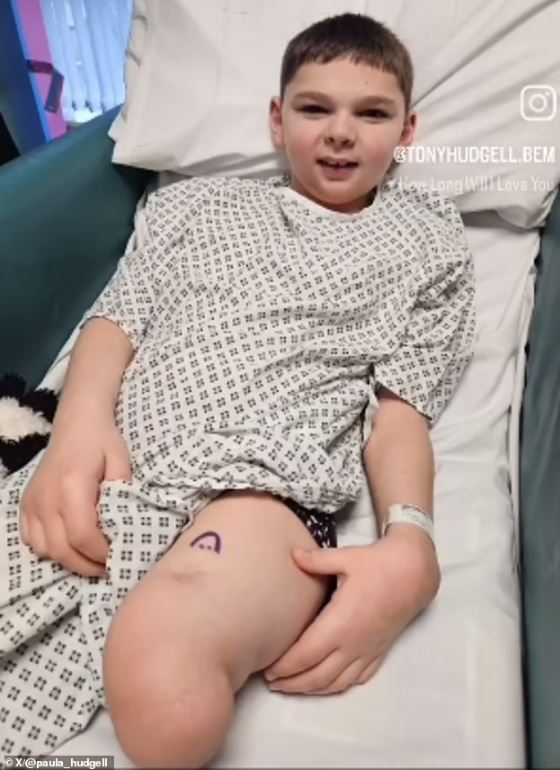 συγκλονιστική ιστορία: έχασε και τα δύο πόδια του λόγω άγριας κακοποίησης από τους γονείς του – το χειρουργείο που μπορεί να του αλλάξει τη ζωή