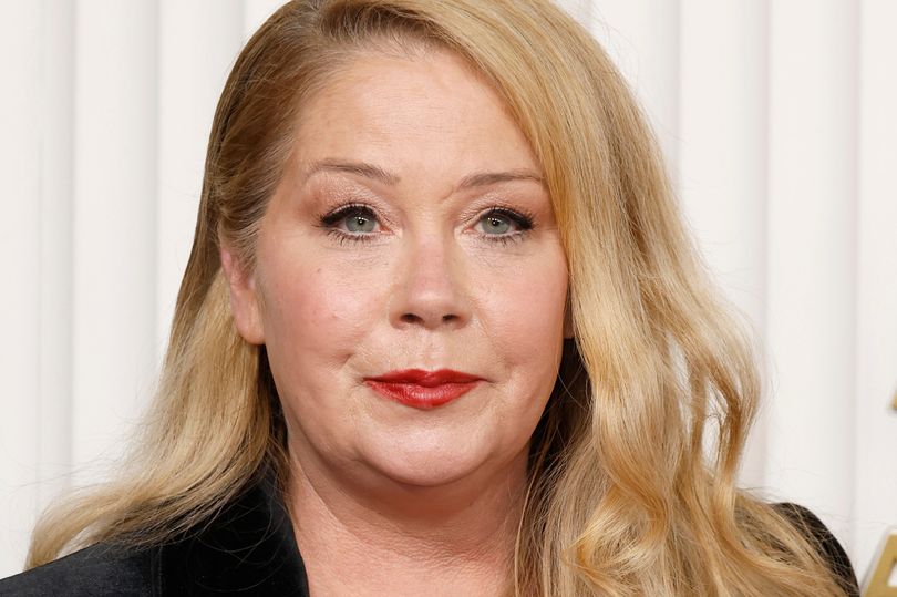 Christina Applegate Says She Has '30 Lesions On Her Brain' Amid MS Battle