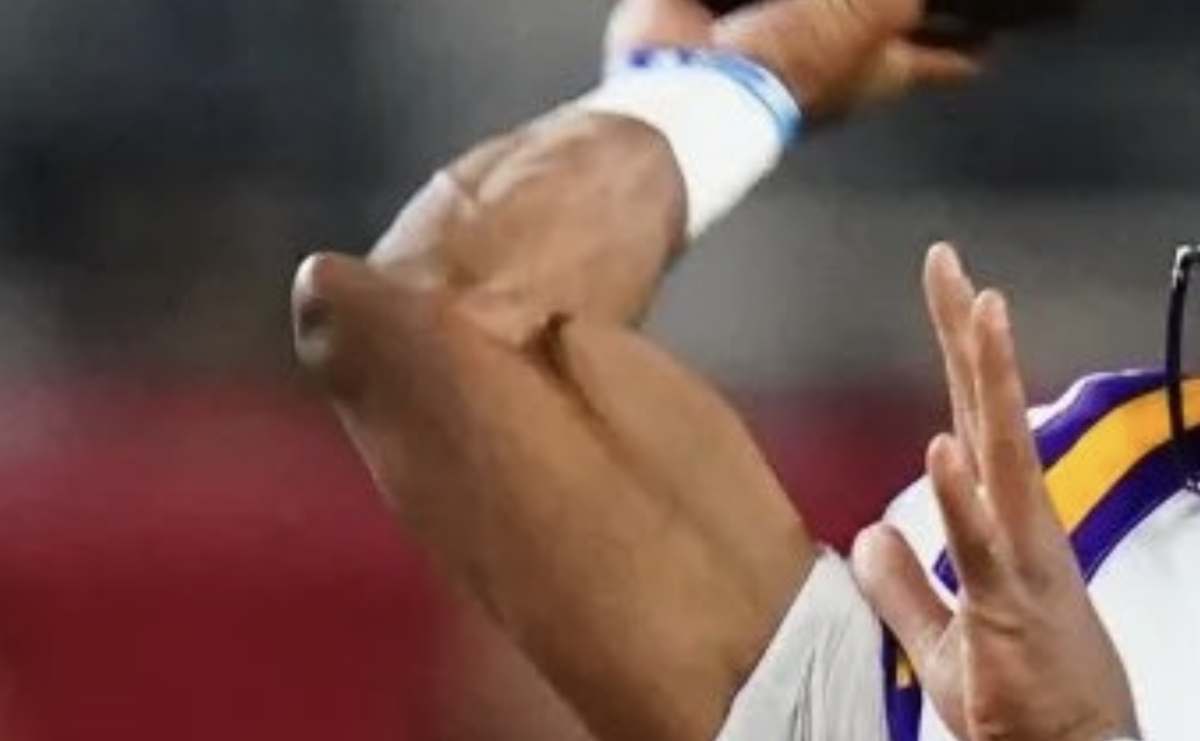 Gross Photo Of NFL Draft Prospect Jayden Daniels' Elbow Is Going Viral