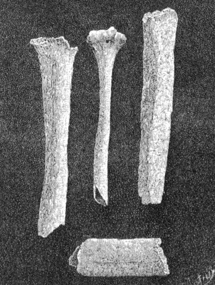 The stories of the tallest humans in history
