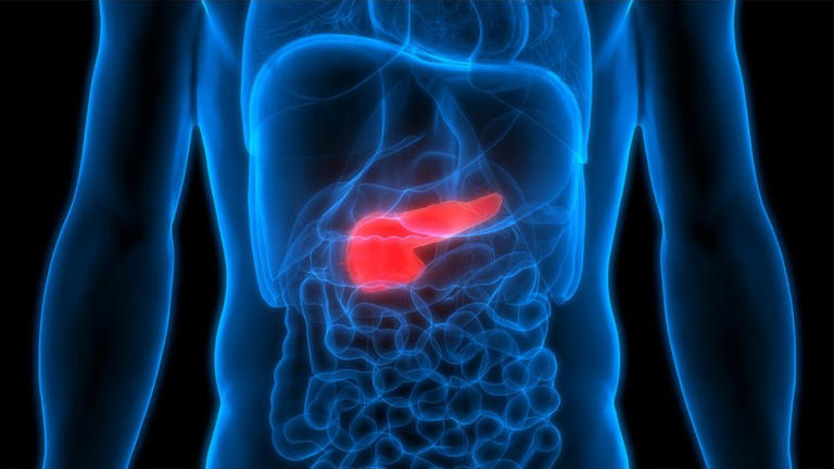 Pancreatic cancer can be hard to diagnose