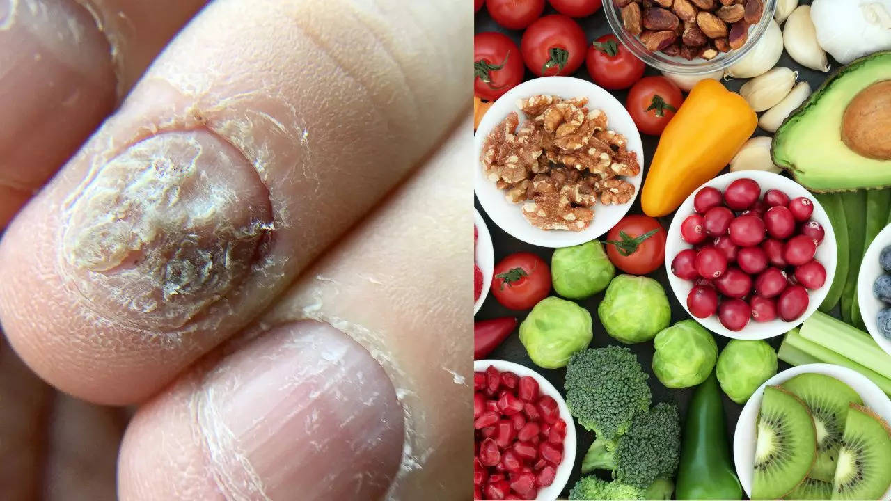 6 foods that can naturally reduce infections