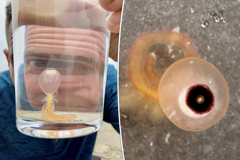 Bizarre stinging ‘spaghetti monsters’ invade beach — experts warn to steer clear of them