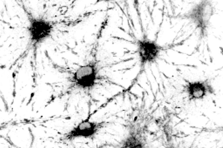 Patterns in the tiny amounts of light emitted by these neural stem cells helped researchers determine whether they were active or dormant without destructive testing. Credit: Darcie Moore