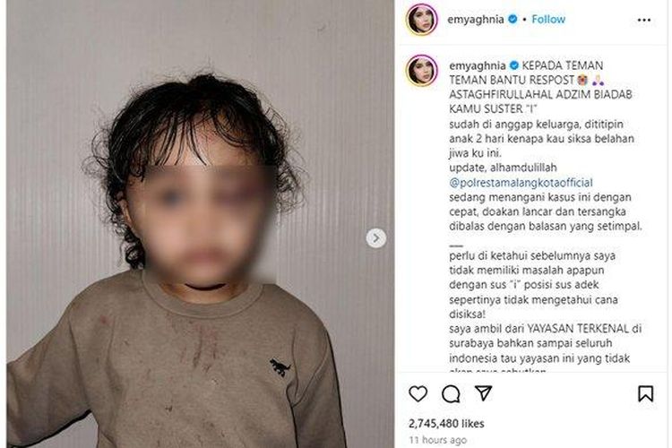 Murka Anaknya Dianiaya Pengasuh Hingga Babak Belur, Inilah Sosok Aghnia ...