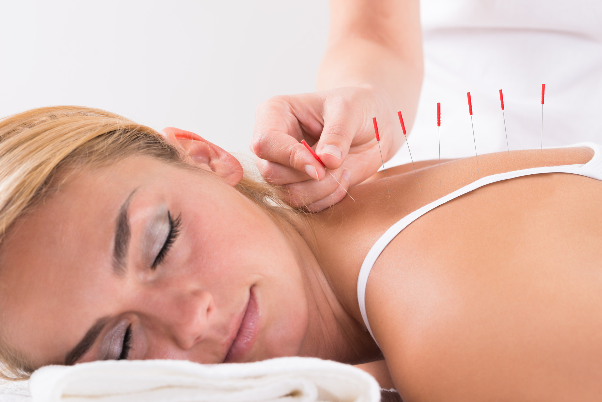 <p>Acupuncture has existed for thousands of years, and indeed it's still popular today. Even if you haven't tried this <a href="https://www.starsinsider.com/lifestyle/454889/stars-who-use-alternative-medicine" rel="noopener">alternative medical treatment</a> yourself, you probably know someone who has. After all, it's a well-known treatment method for individuals battling illness who want to relieve pain and heal themselves without resorting to Western medicine.</p> <p>Most people already know that acupuncture involves the use of thin needles being inserted into different areas of the body, and that they address various health concerns. But there's much more to this treatment than piercing needles in the body.</p> <p>Check out the following gallery for everything you need to know about acupuncture.</p><p>You may also like:<a href="https://www.starsinsider.com/n/125741?utm_source=msn.com&utm_medium=display&utm_campaign=referral_description&utm_content=509810en-us"> The most bizarre objects that fell to Earth </a></p>