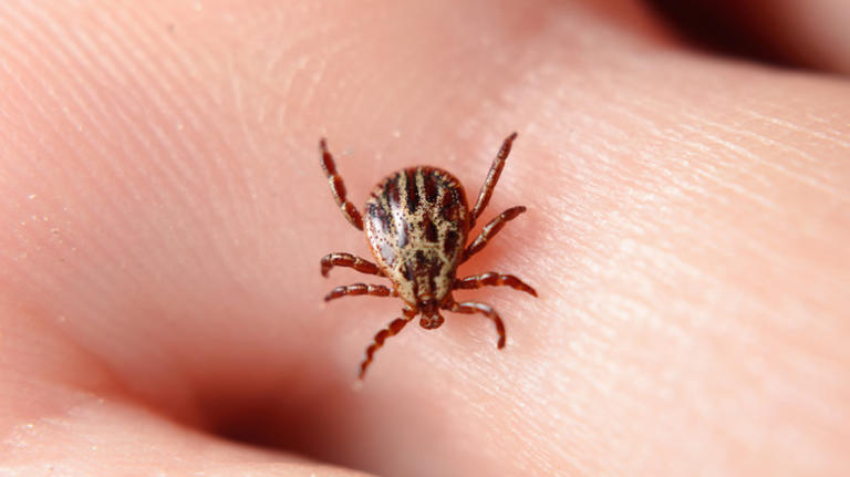 Wood tick on skin