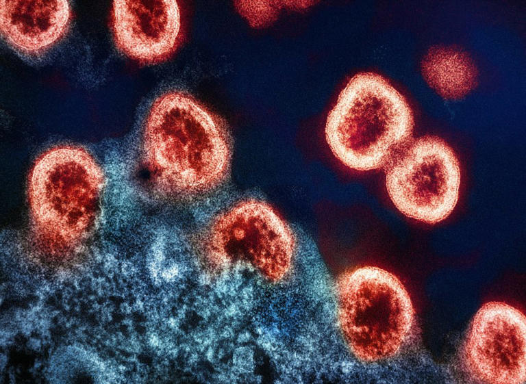 HIV-1 Virus Particles Transmission electron micrograph of HIV-1 virus particles (colorized red) replicating from an HIV-infected H9 T-cell (blue). (Photo by National Institute of Allergy and Infectious Diseases via Unsplash )