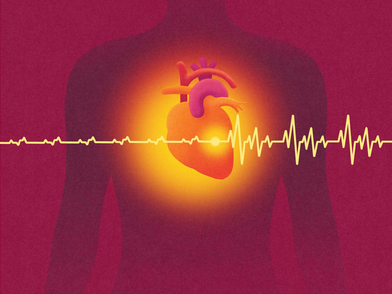 Severe Covid-19 lung infection may harm the heart