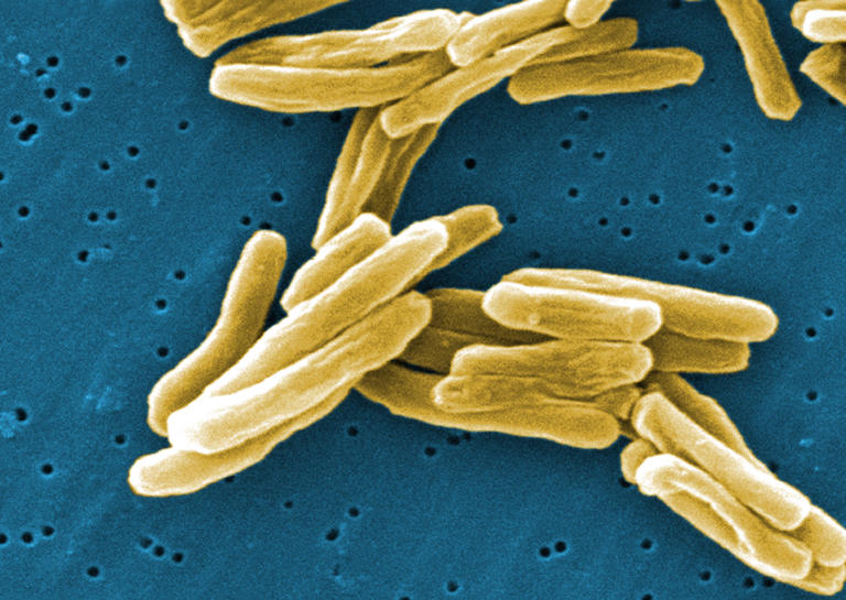 Tuberculosis remains a major killer in low and middle income countries (Janice Carr/Centers for Disease) (PA Media)