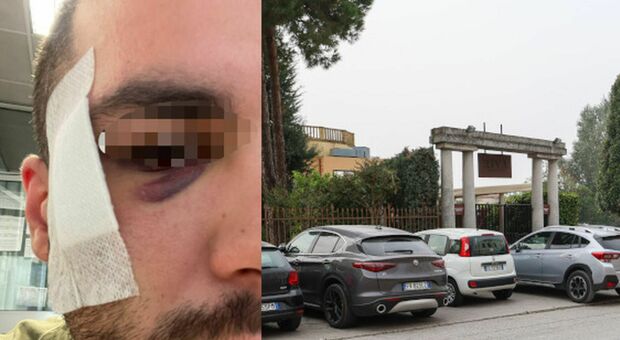 Aggredito E Sfregiato Dal Branco In Discoteca Dopo Aver Salutato Una ...