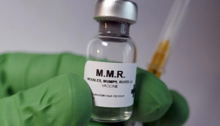 Travellers Warned To Watch For Mumps Symptoms After Infectious Case 