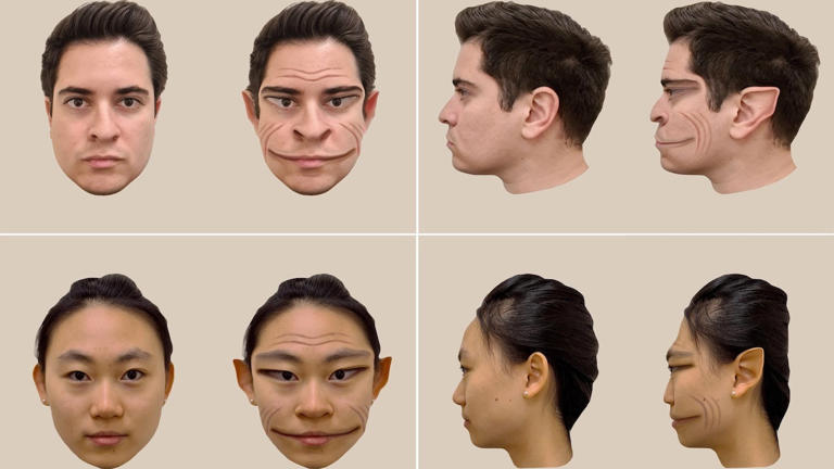 Computer-generated images of the distortions of a male face, top, and female face, bottom, as perceived by a 58-year-old patient in a new study. Fox News