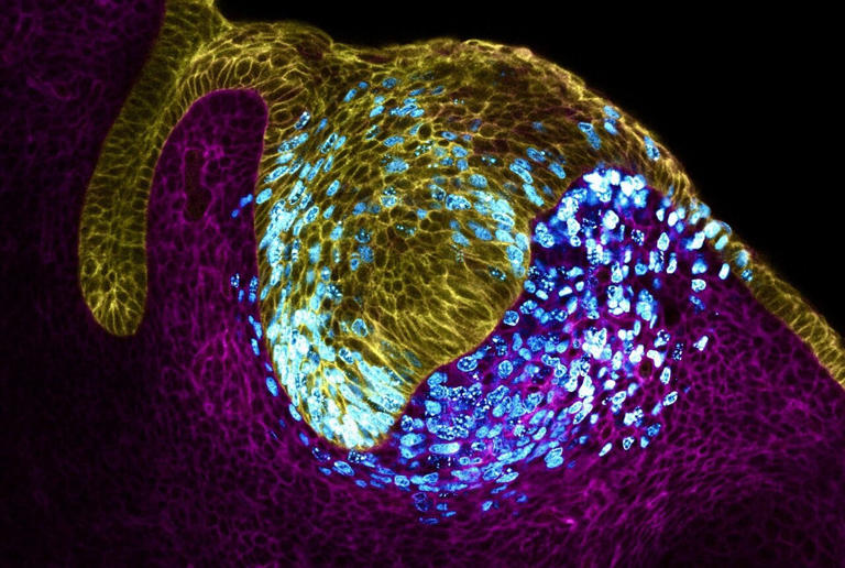 Scientists discover pressure determines which embryonic cells become ...