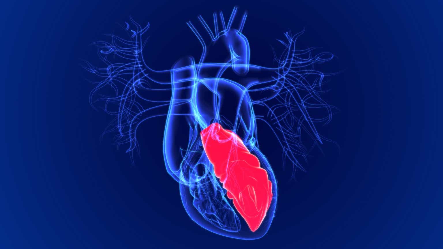 Cytokinetics Releases More Data On Hypertrophic Cardiomyopathy Drug ...