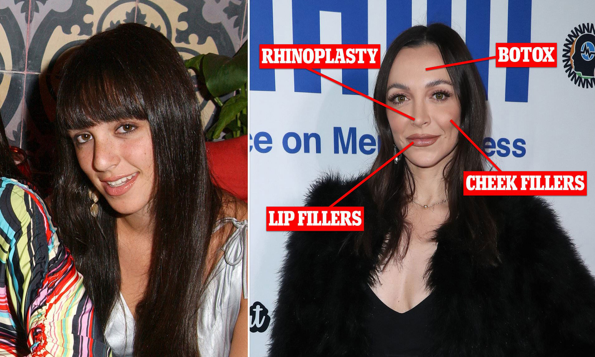 Plastic surgeons reveal list of cosmetic that Kyle Richards' daughter ...