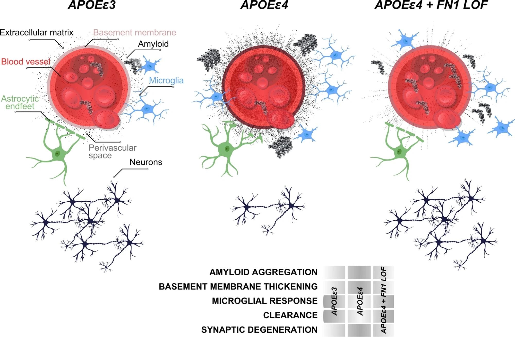 study unlocks genetic secrets in apoeε4 carriers that could defend against alzheimer's