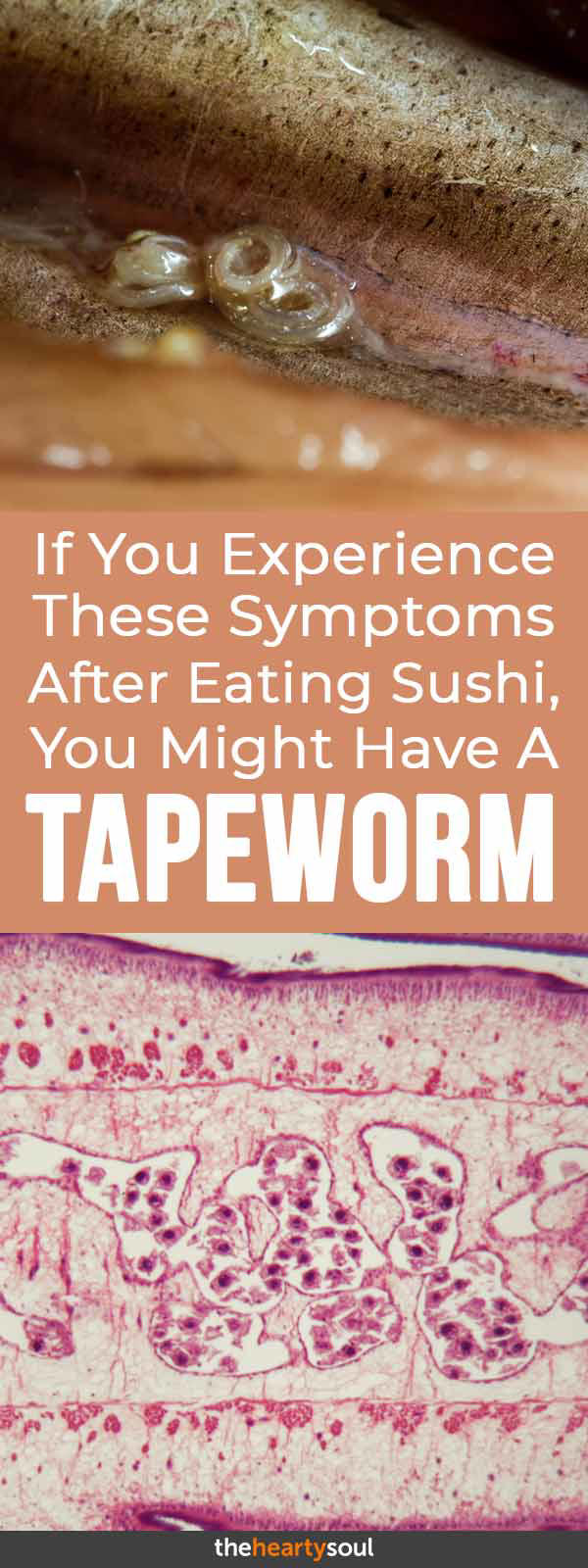 Sushi Tapeworm Measured At Over 5 Feet Long Is An Eye Opener