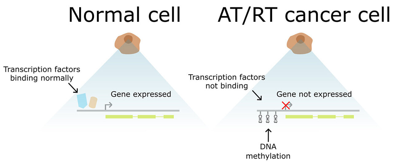 Study Sheds Light On The Mechanisms Underlying The Development Of ...