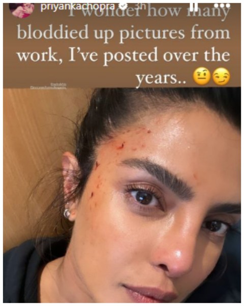 android, priyanka chopra sustains bruises on face while shooting heads of state: ‘bloodied up pictures from work’
