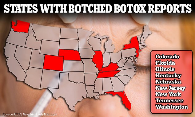 cdc investigating botched botox shots in 9 states hospitalizing women