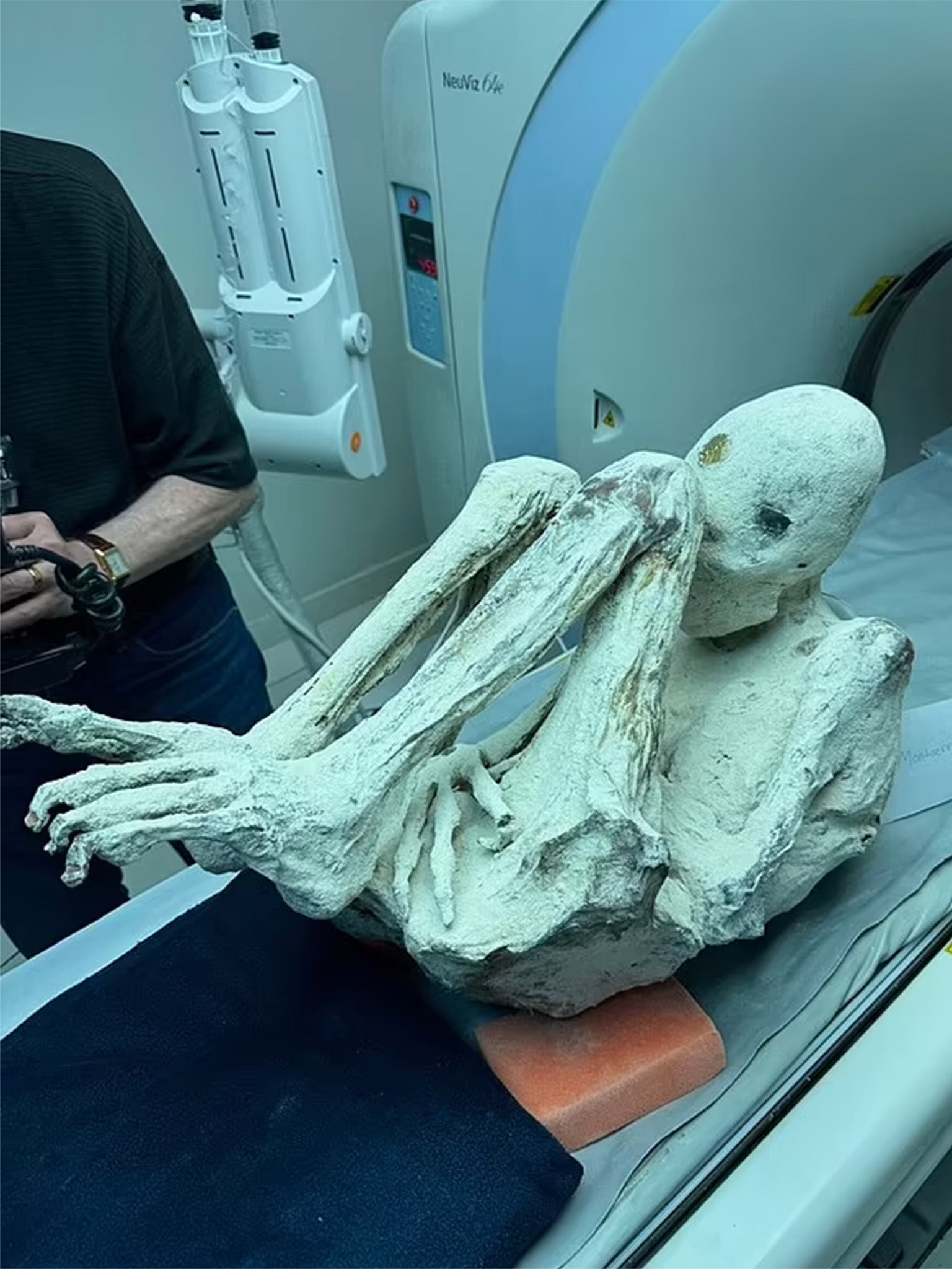 bizarre case of peru alien mummies takes another turn as officials raid ‘pregnant specimen’ press conference