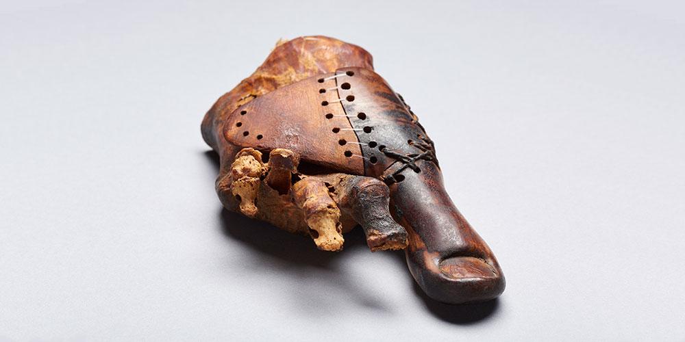 4 próteses da antiguidade que demonstram o avanço da medicina