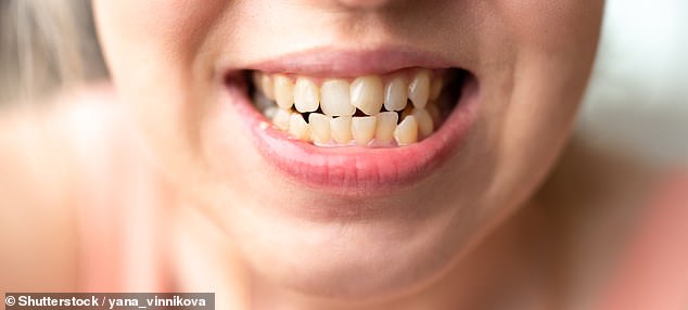 those who lose teeth from poor oral hygiene more likely have back pain