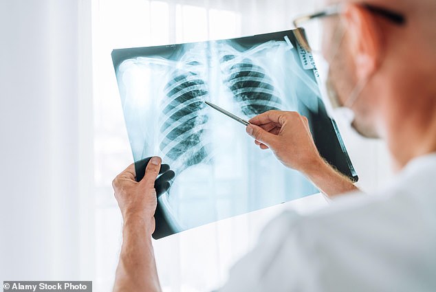 cancer breakthrough as doctors claim a.i. x-ray will save hundreds
