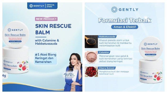 review gently skin rescue balm,pertolongan pertama biang keringat dan ruam kulit bayi