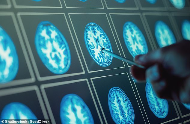 nhs to roll out laser beam surgery to prevent epileptic seizures