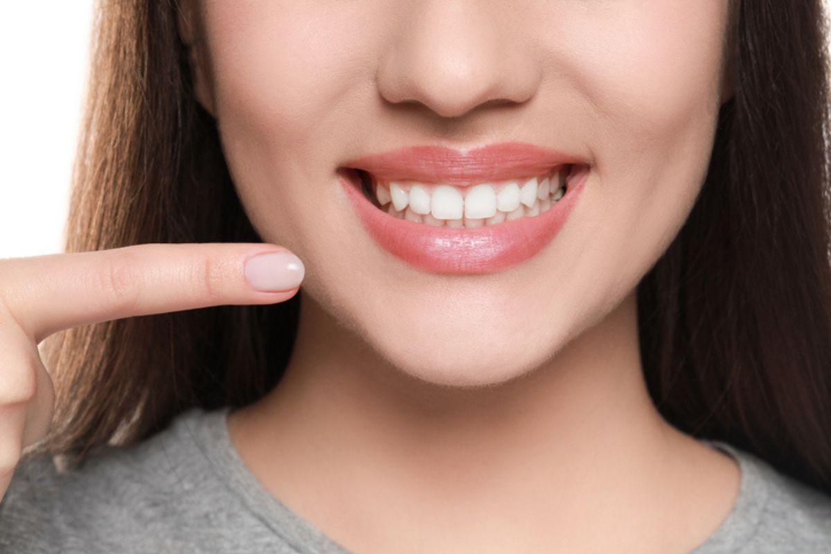 alimentos que blanquean tus dientes sin necesidad de recurrir al láser