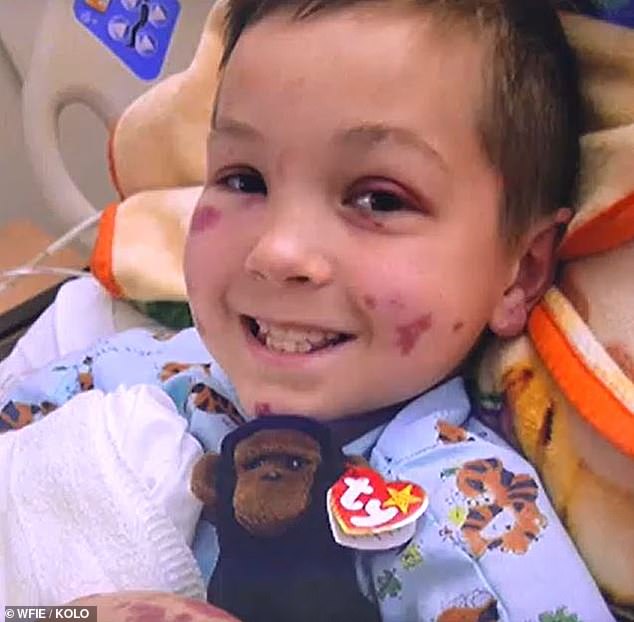 boy, 10 finds out he's got rare blood vessel disorder after vomiting