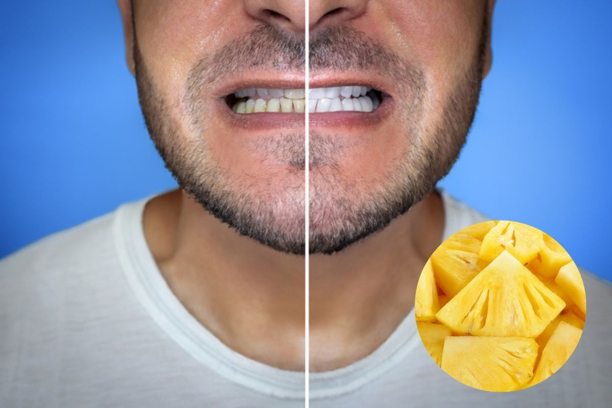 alimentos que blanquean tus dientes sin necesidad de recurrir al láser