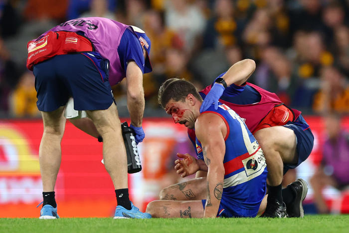 beveridge remains coy on concussed libba's future