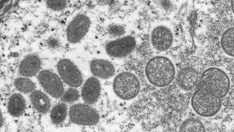 des chercheurs belges découvrent une mutation du virus de la variole du singe