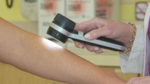 Harrisonburg dermatologist discusses skin cancer prevalence, prevention