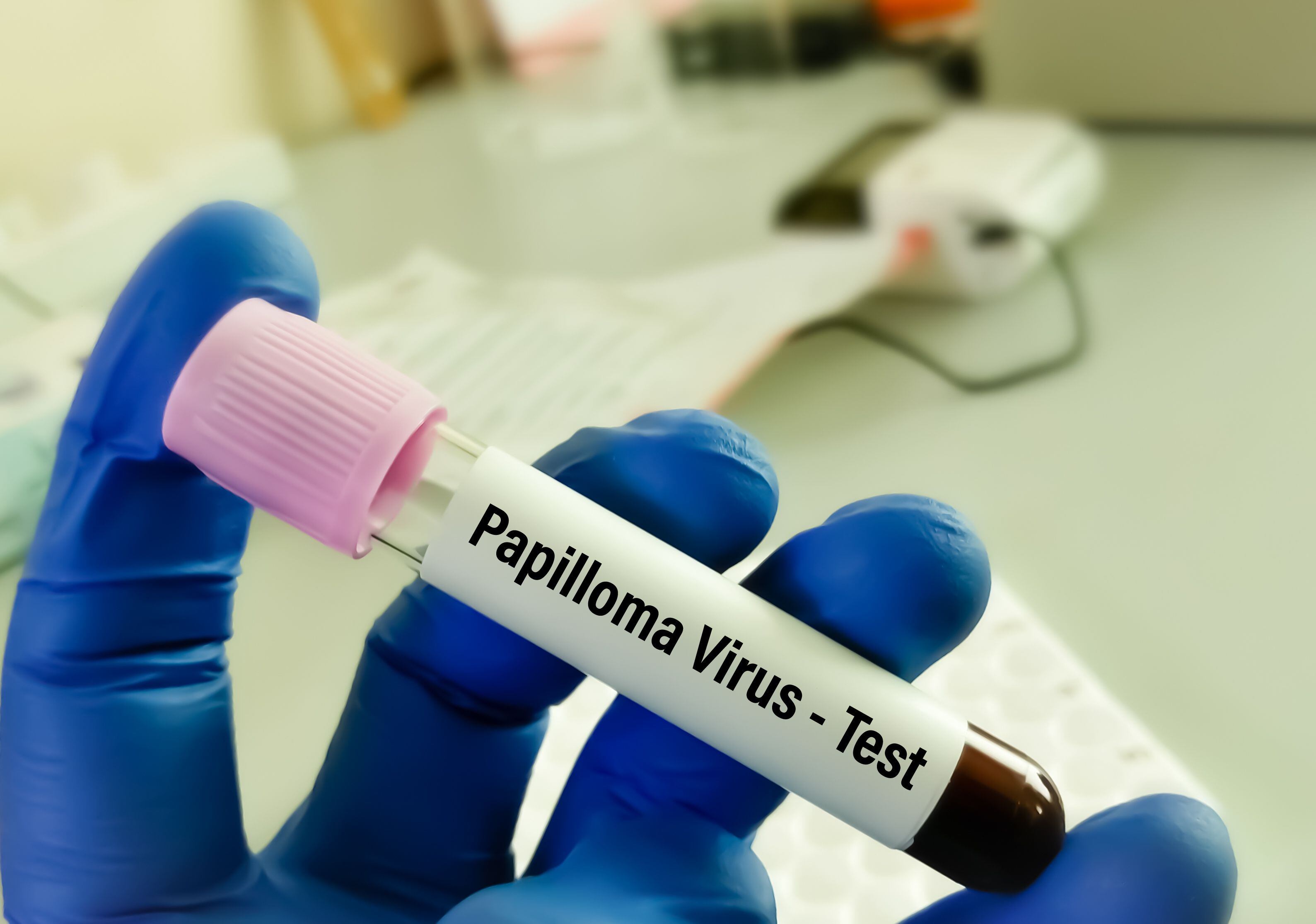 ¿el virus del papiloma humano tiene tratamiento? experto responde