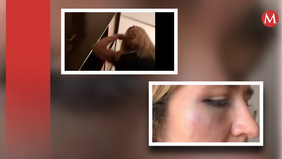 captan a mujer golpeándose en la cara luego de acusar a su ex cuñado de agredirla | video