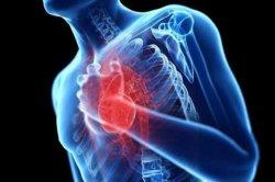 5 cara mudah dan ampuh mengatasi penyakit jantung aritmia agar cepat sembuh