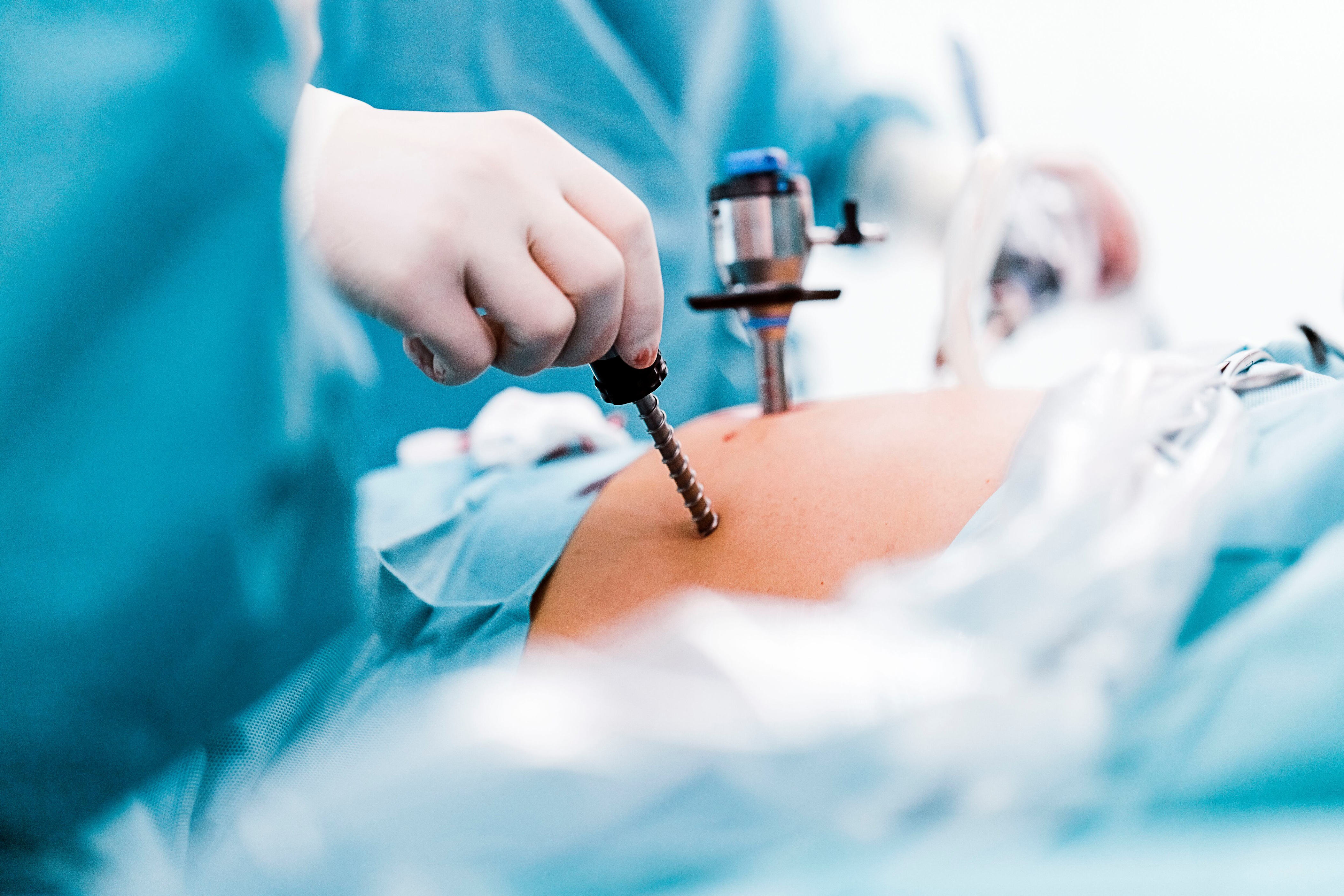 ¿cuáles son las complicaciones y posibles riesgos de una cirugía bariátrica?