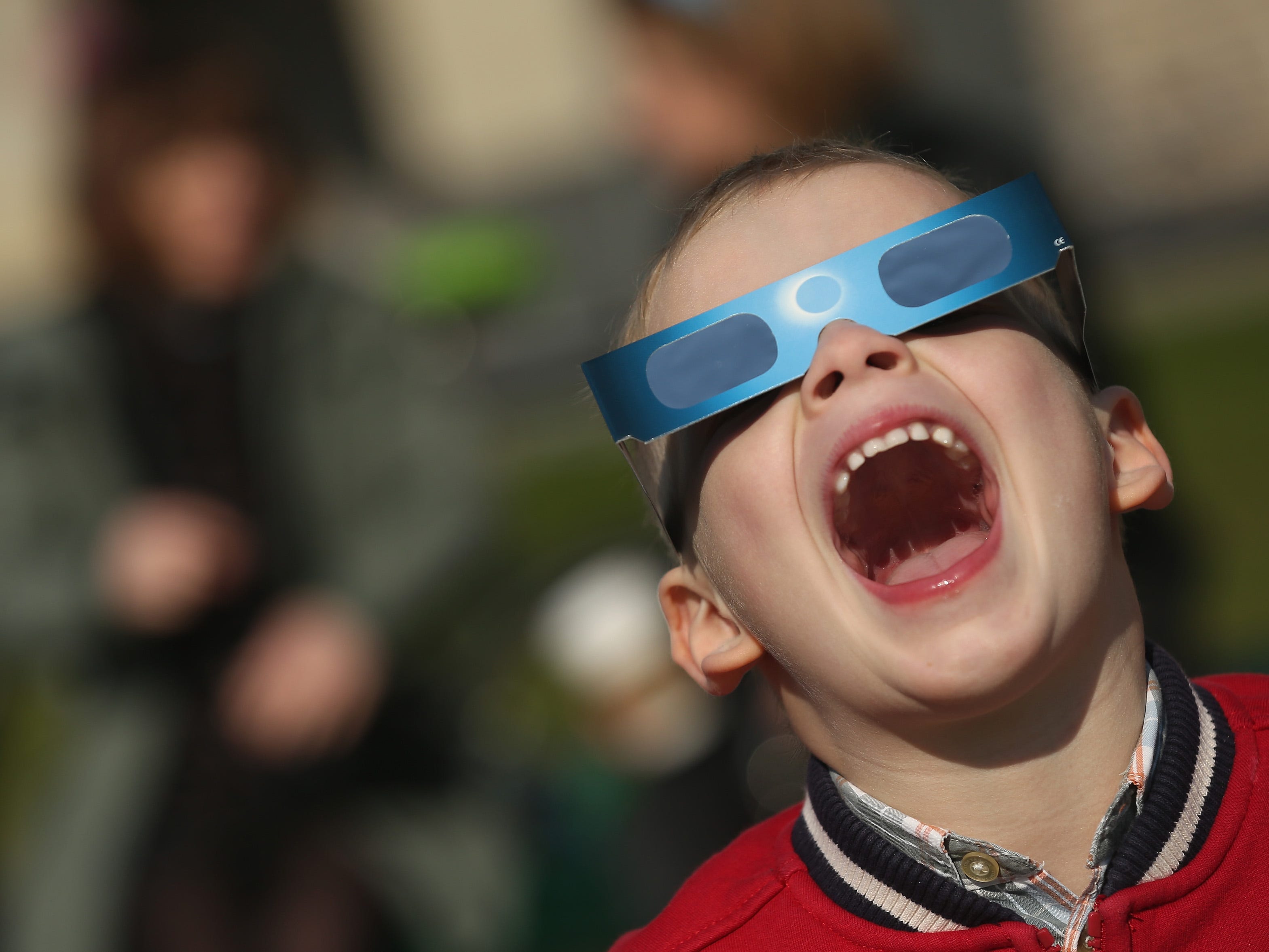 microsoft, if your eyes hurt after watching the solar eclipse, here's what you need to know