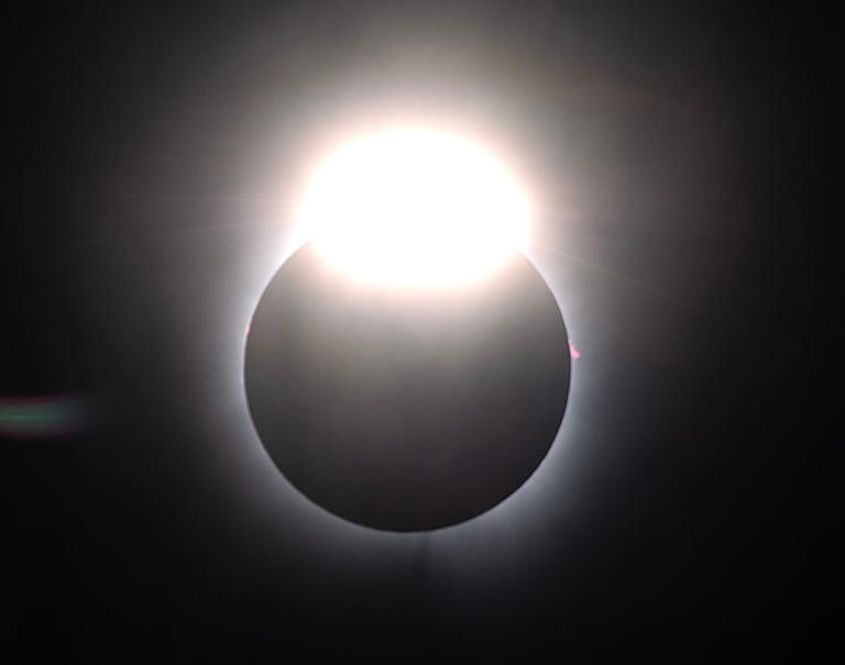 How to tell if you damaged your eyes looking at the solar eclipse