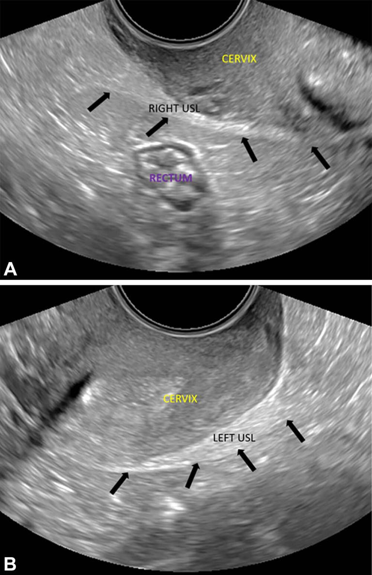 New consensus statement aims to improve endometriosis evaluation