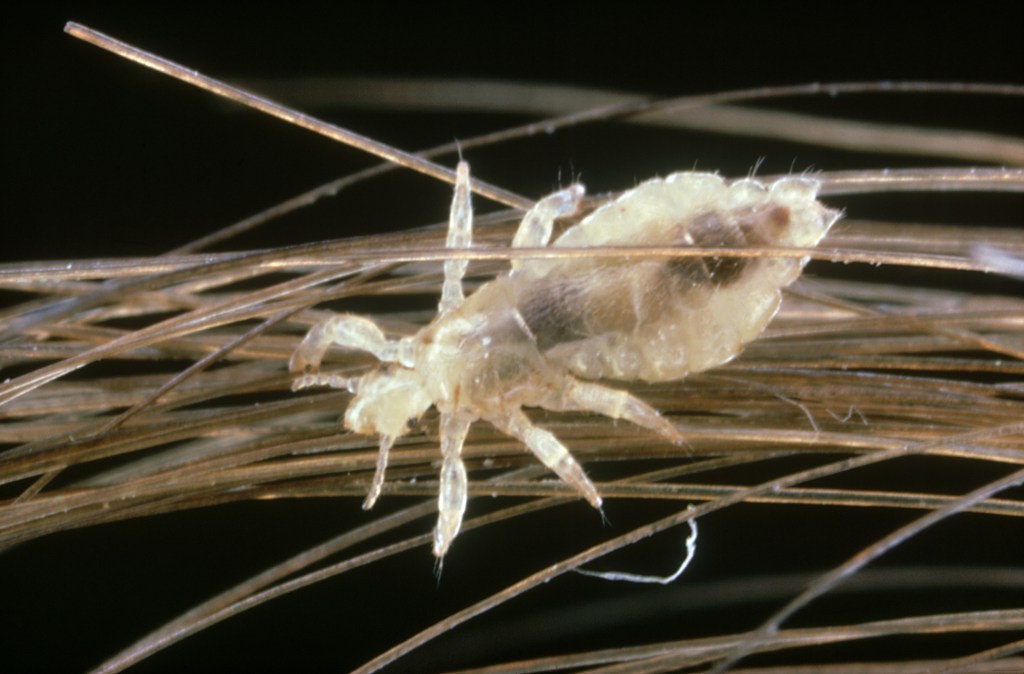 Rats, lice, wasps and cockroaches among pests plaguing NHS hospitals