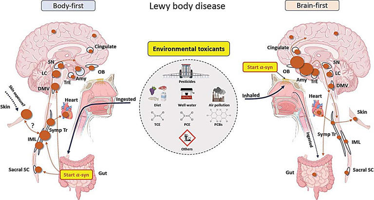 A proposal on how environmental exposure to toxicants may cause either body-first or brain-first Lewy body disease. The size of the brown circles reflects the amouth of Lewy pathology in each region. Credit: Aarhus University Hospital/University of Rochester Medical Center