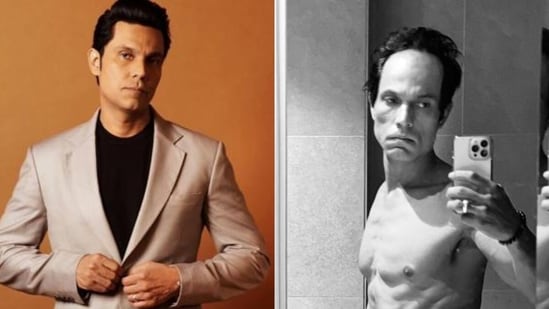 randeep hooda on drastic transformation: my body is revolting against normal now
