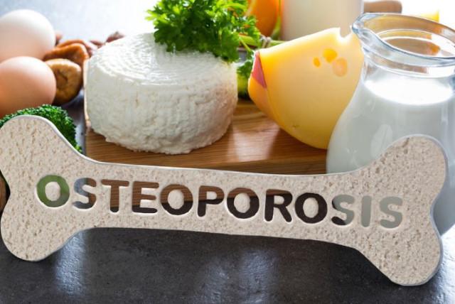 tome nota: 4 verduras ricas en magnesio que debe consumir para prevenir la osteoporosis