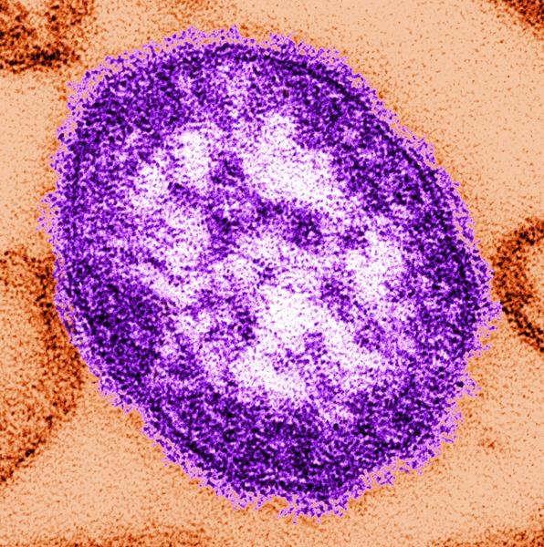 us measles cases are up in 2024. what's driving the increase?