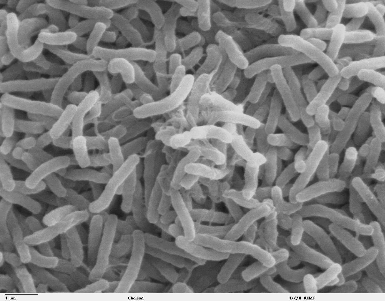 mayotte: quatre nouveaux cas de choléra importés des comores détectés